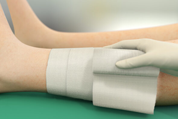 Person fester Sorbact Absorption-bandasje med en fikseringsbandasje rundt benet.
