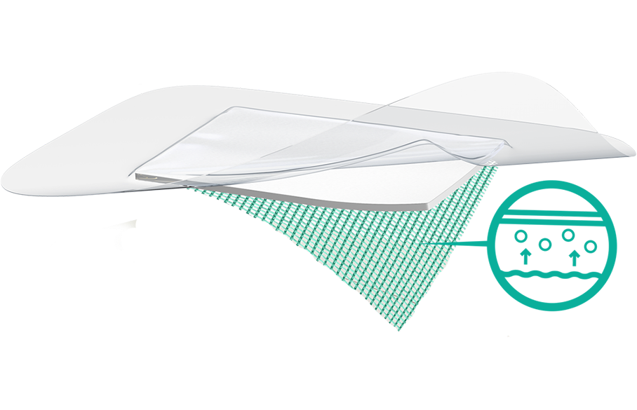 Illustrasjon av et Sorbact-bandasje lag, og at bakterier bindes i bandasjens grønne overflate.